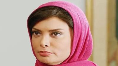 خبر روز | عکس های شوکه کننده نگار فروزنده بعد از عمل های زیبایی | گلی شی