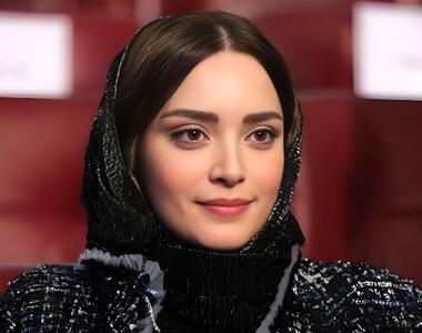 بهنوش طباطبایی چند عمل زیبایی انجام داده است؟ (تصاویر)