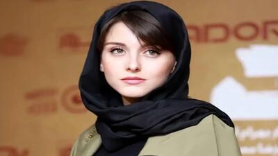 عکس/تیپ خانم بازیگرِ زخم کاری کنار برج ایفل