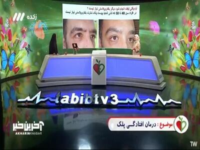 آیا وقتی لیفت ابرو انجام شود نیازی به بلفاروپلاستی نیست؟