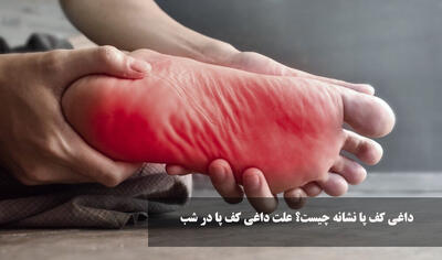 داغی کف پا نشانه چیست؟ علت داغی کف پا در شب + درمان خانگی داغی کف پا