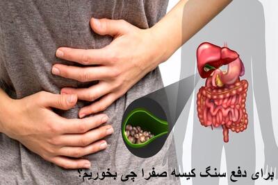 برای دفع سنگ کیسه صفرا چه غذا و دارویی بخوریم؟ قویترین داروی گیاهی سنگ شکن صفرا