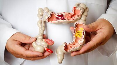 روشی ساده برای پیشگیری از یبوست