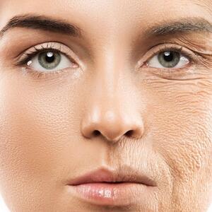 از بین بردن چین وچروک صورت با آلوئه‌ورا؛ راهکاری ساده و ساده - سبک ایده آل