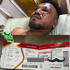 عکس/تنها بازمانده سقوط هواپیما در هند | اقتصاد24