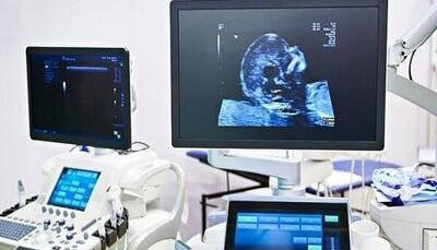غربالگری و تشخیص به موقع، اولین گام در درمان بیماری فنیل کتونوری است