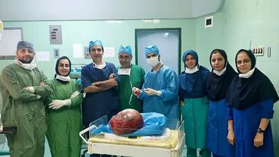 خارج‎‌کردن تودۀ ۱۱ کیلویی از شکم بیماری در آمل (فیلم)