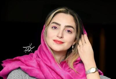 نگاه روز | چهره عجیب حیوان خانگی «نهال دشتی» که خیلی دوستش دارد