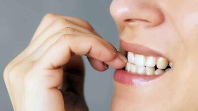 با این عادت ها چهره خود را زشت نکنید!