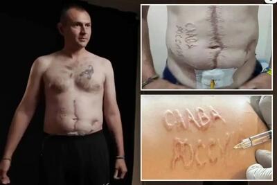 روایت هولناک اسیر جنگی اوکراینی از شکنجه‌های شدید؛ از داغ کردن بدن تا شوک الکتریکی به آلت تناسلی