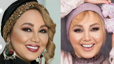 تصویر روز | موهای عجیب و دیدنی بهنوش بختیاری؛ شبیه به آن شرلی | گلی شی