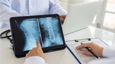 بازگشت‌ناپذیری آسیب‌های نخاعی در جابه‌جایی غیرحرفه‌ای