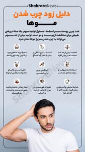 اینفوگرافی| دلیل زود چرب شدن موها