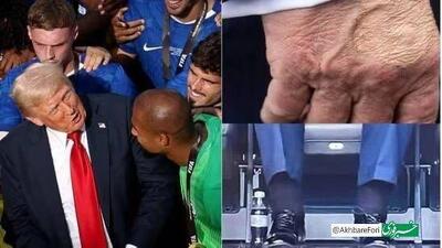 ترامپ تومور گرفت!
