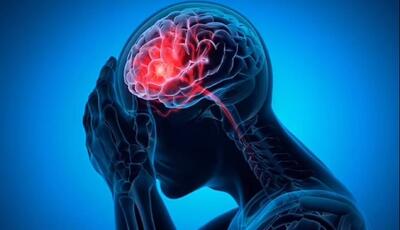 شایع‌ترین علت خونریزی مغزی را بشناسیم
