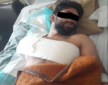 قطع دست کارگر بروجردی از بازو/ حقوق این کارگر فقط شش میلیون تومان بوده است!