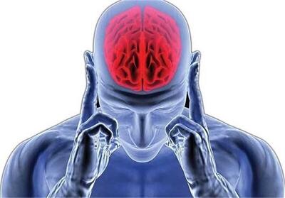 هر ۷دقیقه یک ایرانی مبتلا به آلزایمر می‌شود/ ممنوعیت درمان خانگی سکته مغزی