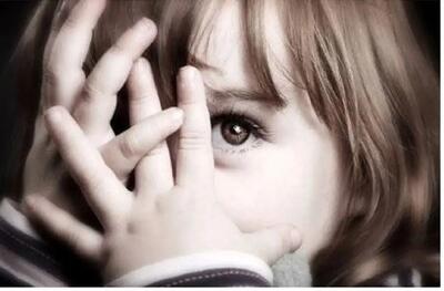 پوست صورت و بدن این دختر جوان شبیه گاو است+ عکس