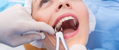 فیلم/ لحظه هولناک انفجار دستگاه دندانپزشکی در دهان بیمار
