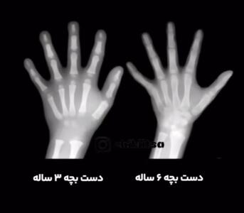 نوشتن قبل از ۶ سالگی ممنوع! - سبک ایده آل