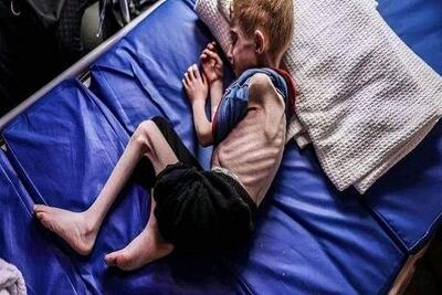 هشدار شدیداللحن ۱۰۹ سازمان امدادرسان درباره گرسنگی در غزه